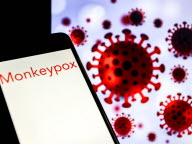 Mpox (variole du singe) : sur les réseaux sociaux, une épidémie de fake news